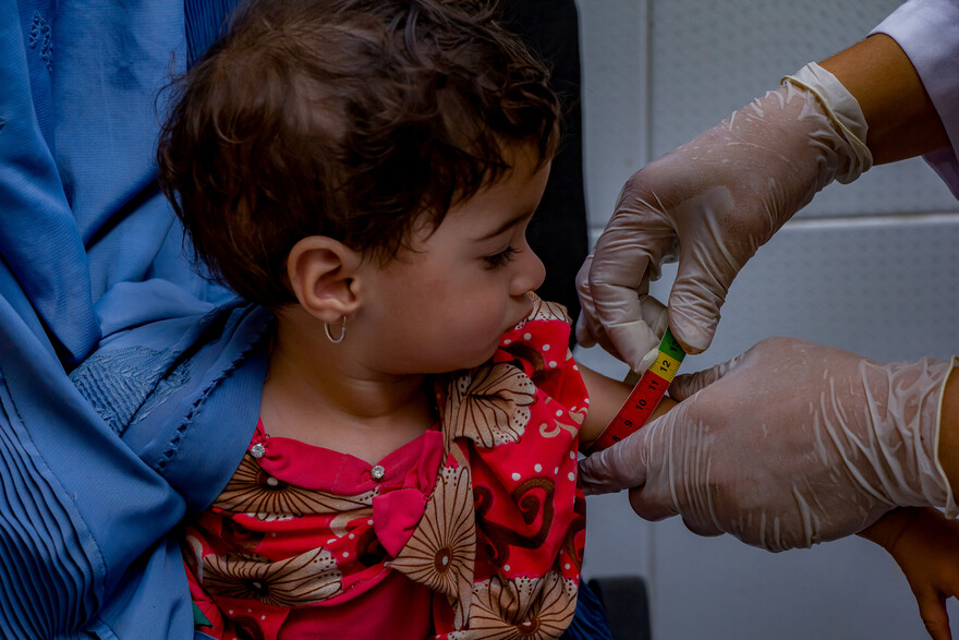 Viele Kinder in Afghanistan sind unterernährt 