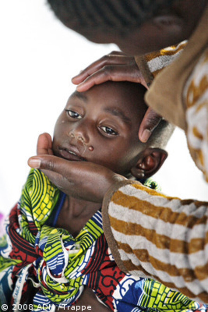 Kongo: Kranker Junge im Cholera Camp