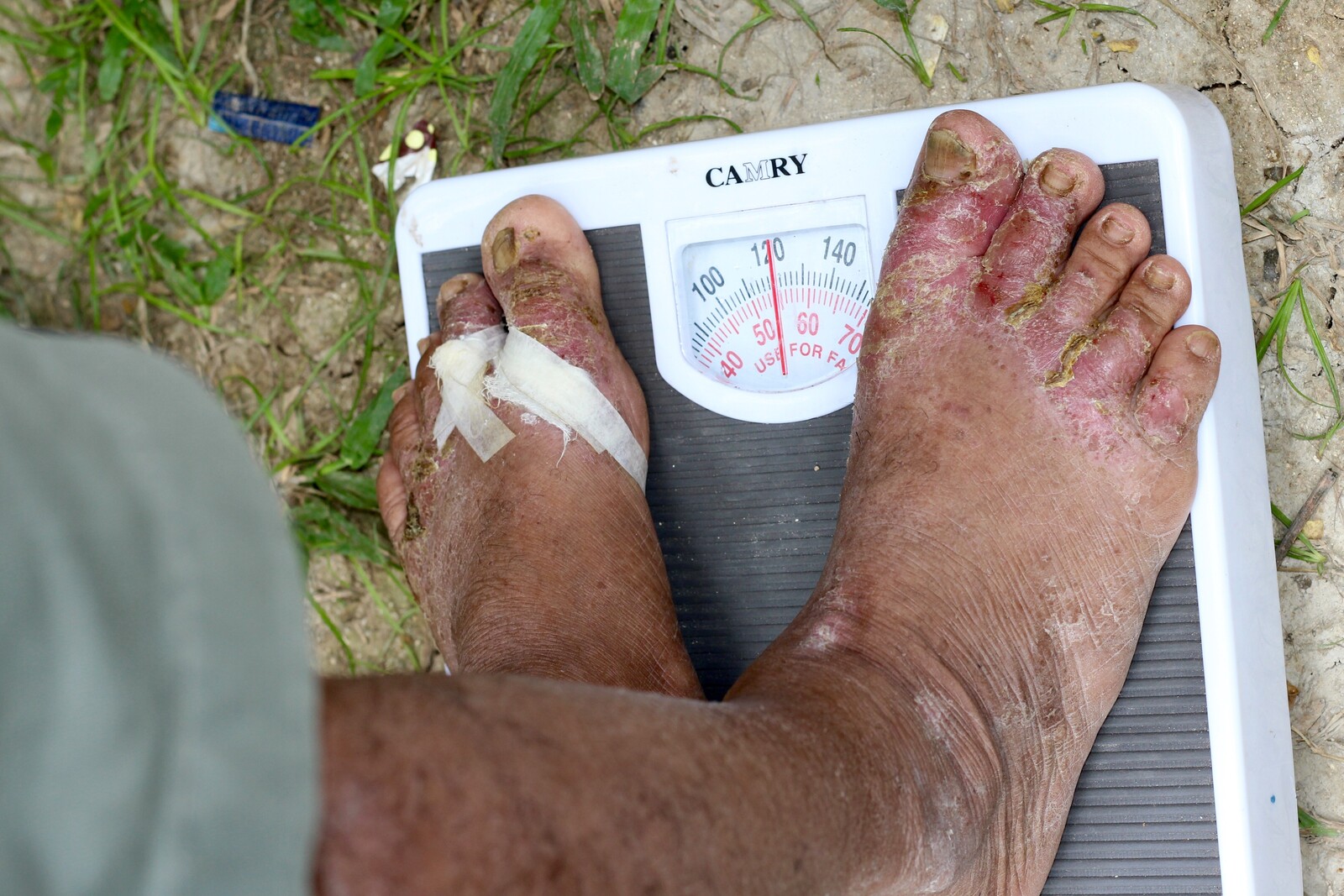 Taifun Haiyan Gewicht Wiegen Mann