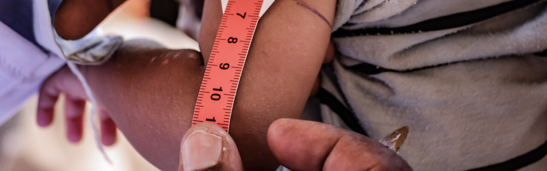 Einem Kind im Sudan wird der Oberarmumfang mit einem Hungermaßband gemessen