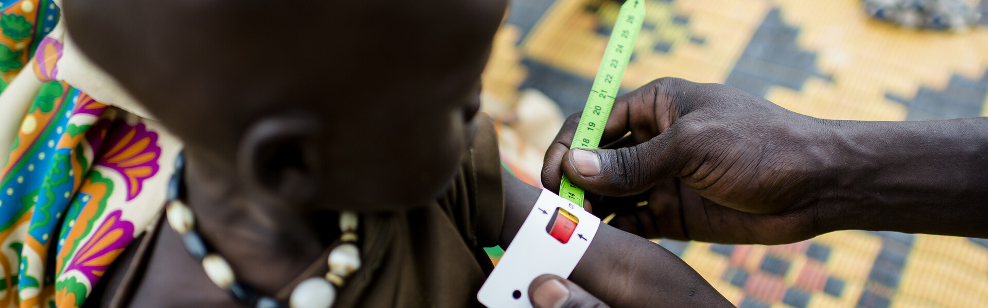 Ein unterernährtes Kind im Südsudan wird untersucht