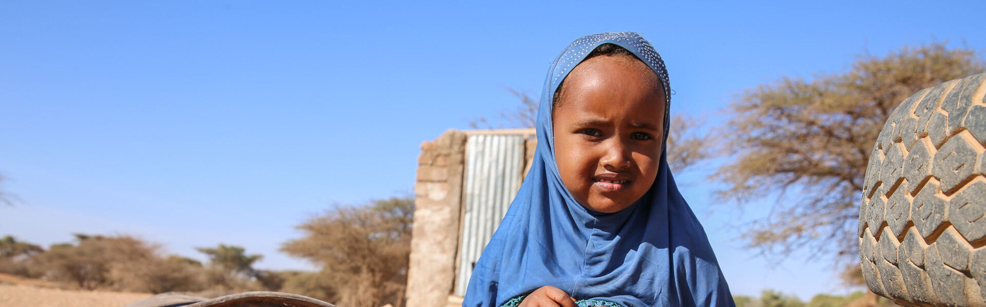 In Somalia sind Kinder stark unterernährt