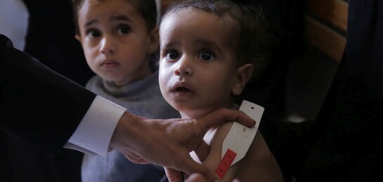 Ein kleines Kind mit Hungermaßband: Es leidet an Unterernährung und Cholera
