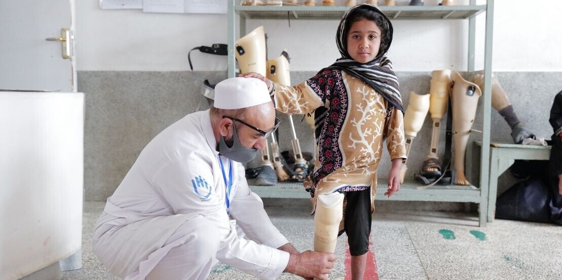 Ein Arzt von Handicap International passt bei einem Mädchen eine Beinprothese an Ein Arzt von Handicap International passt bei einem Mädchen eine Beinprothese an