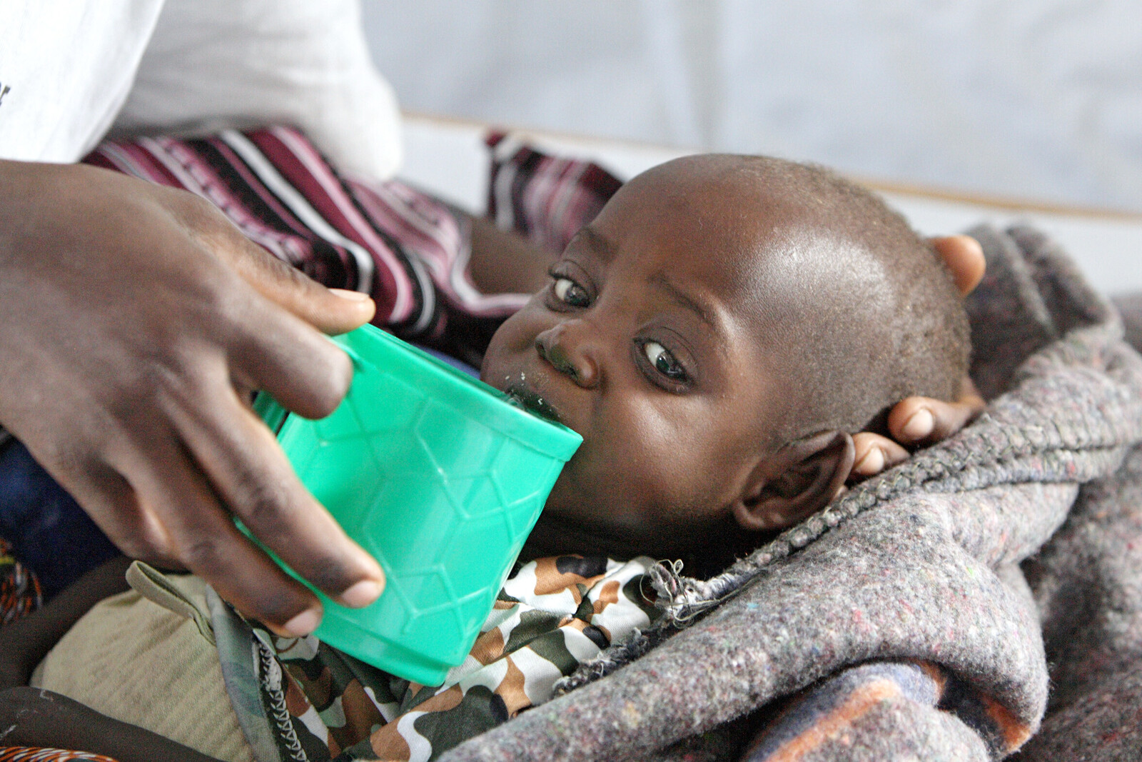 Bei Hungersnöten sind es meist die Kinder, die mit schwerer Unterernährung zu kämpfen haben. Das hat Auswirkungen auf das Wachstum und endet in vielen Fällen tödlich.