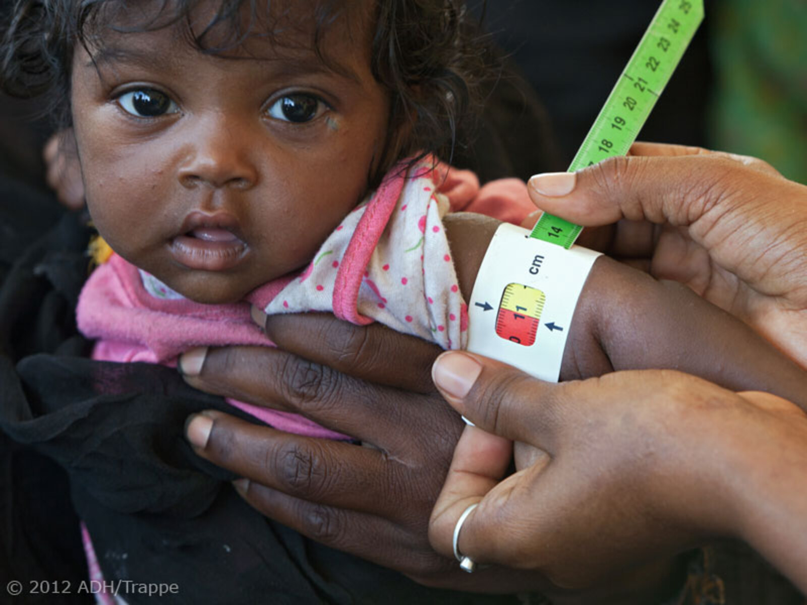 In einem Gesundheitszentrum von Islamic Relief wird der Oberarmumfang eines Kindes gemessen.