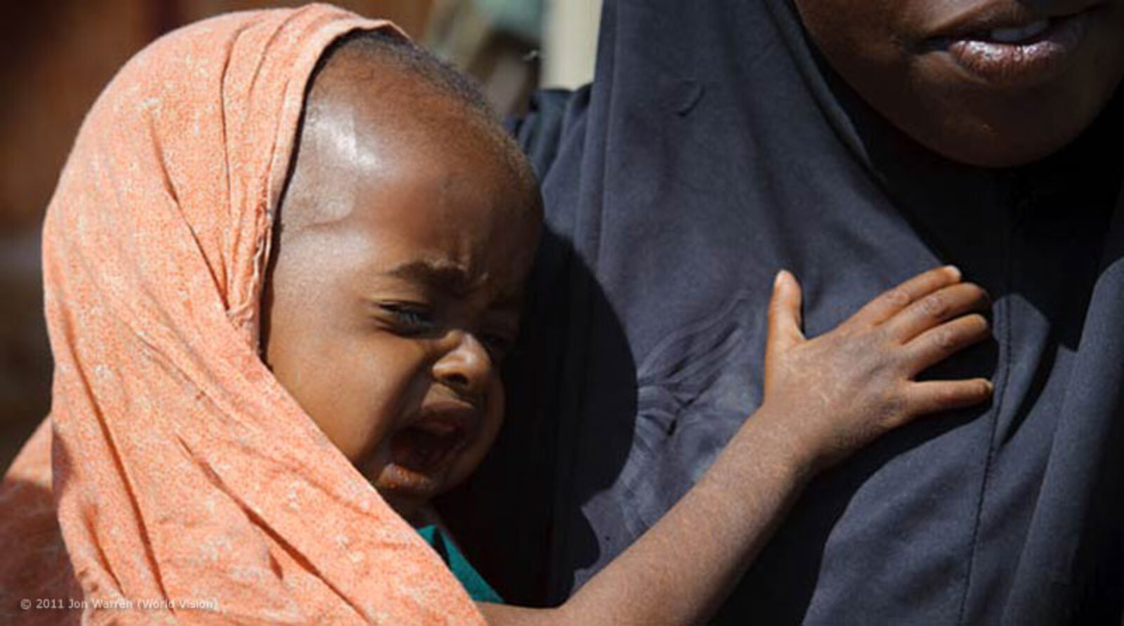 Das Muuse Rootile Camp besteht aus sechs kleineren Camps und liegt im Randgebiet von Garowe, Somalia. Hier bringen Mütter ihre Kinder hin, um Hilfe zu bekommen. Die Messung des Oberarmumfangs dieses Kindes bestätigt seine schwere Mangelernährung...