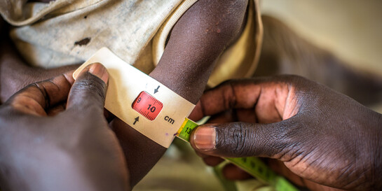 Ein Kind im Südsudan: Das Hungermaßband zeigt Rot