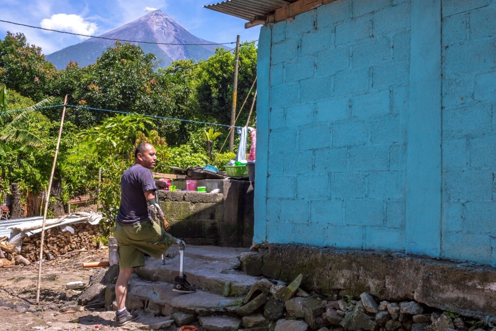 Ein Mann mit einer Beinprothese in Guatemala steigt eine Steintreppe zu seinem Haus empor 