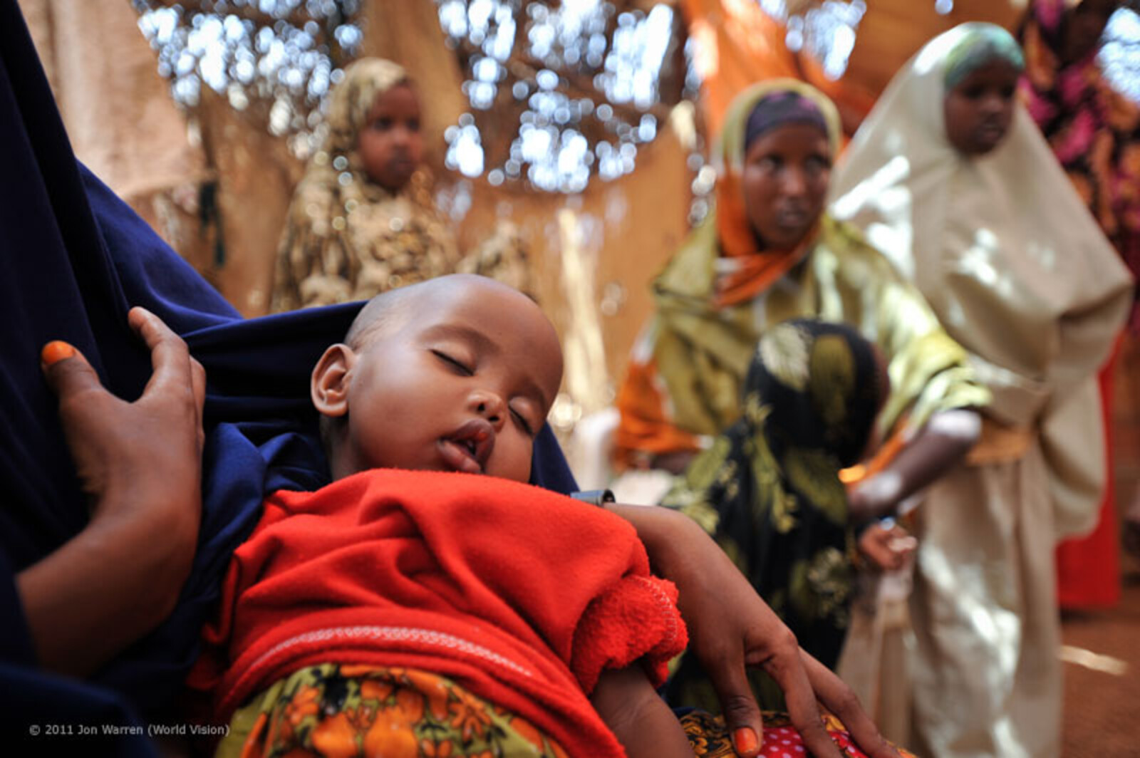 Mit seinen acht Monaten leidet Naimo bereits unter Tuberkulose und Unterernährung. World Vision versorgt auch ihn, führt Impfungen gegen Tuberkulose und Masern durch. Naimos Eltern haben bis auf fünf Ziegen alles verloren und sind nun arbeitslos. Ihre Zuk