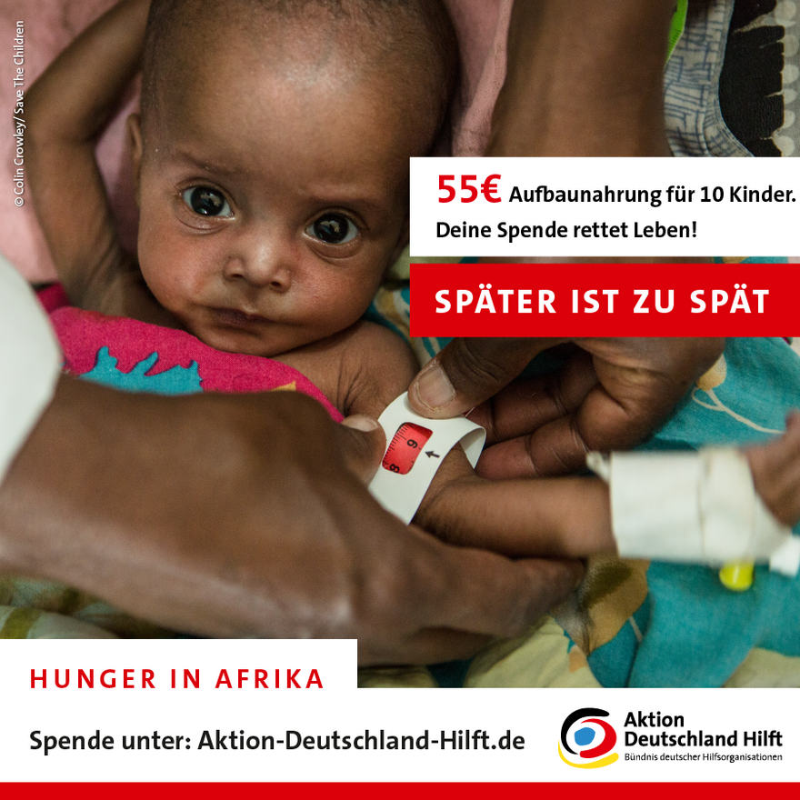 Ein hungerndes Kind in Somalia - jede Hilfe zählt Ein hungerndes Kind in Somalia - jede Hilfe zählt