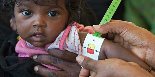Einem Baby in Äthiopien wird der Arm mit einem Hungermaßband abgemessen (Archivbild)