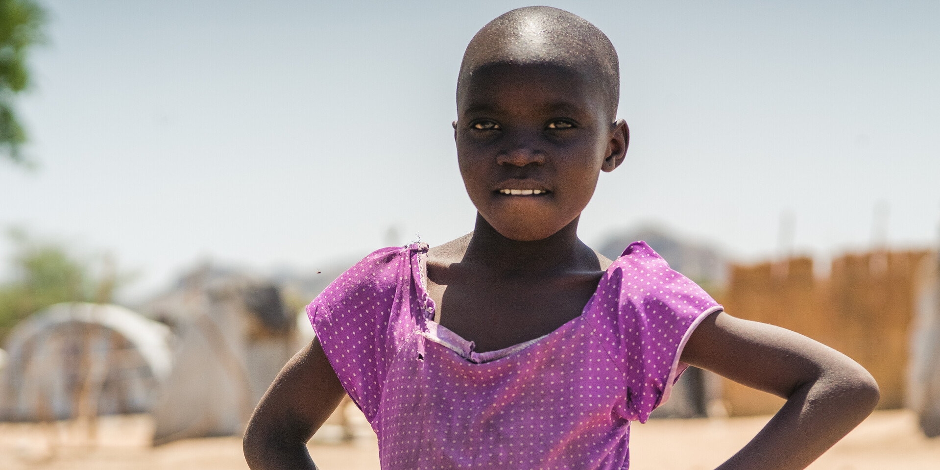 Ein Mädchen im Südsudan. Auch dort ist Genitalverstümmelung verbreitet 