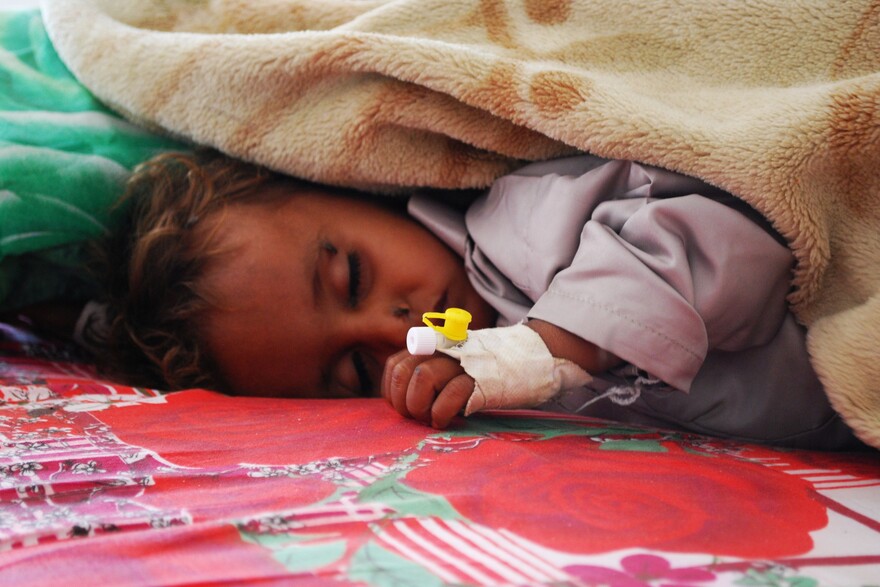 Ein an Cholera erkranktes Kind im Jemen Ein an Cholera erkranktes Kind im Jemen
