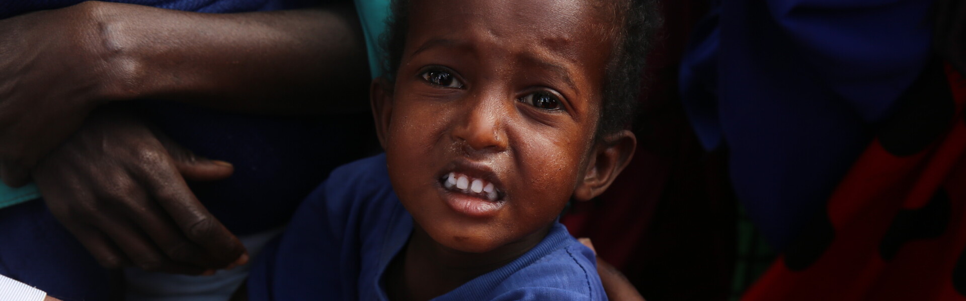 Ein Kind wird in Afrika der Arm gemessen. Es leidet unter der Hungersnot in Afrika