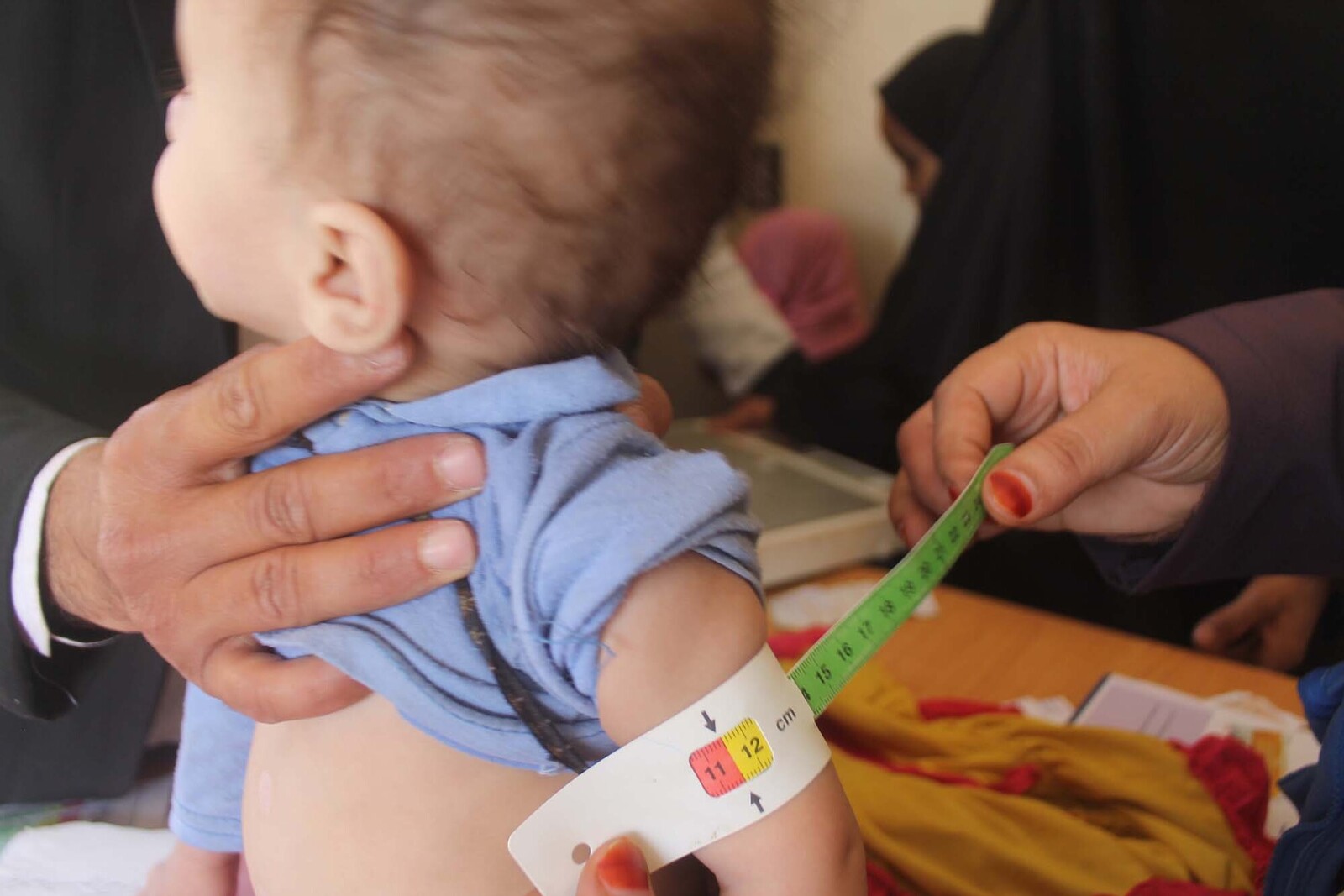 Ein Helfer misst das dünne Ärmchen eines mangelernährten Kindes im Jemen 