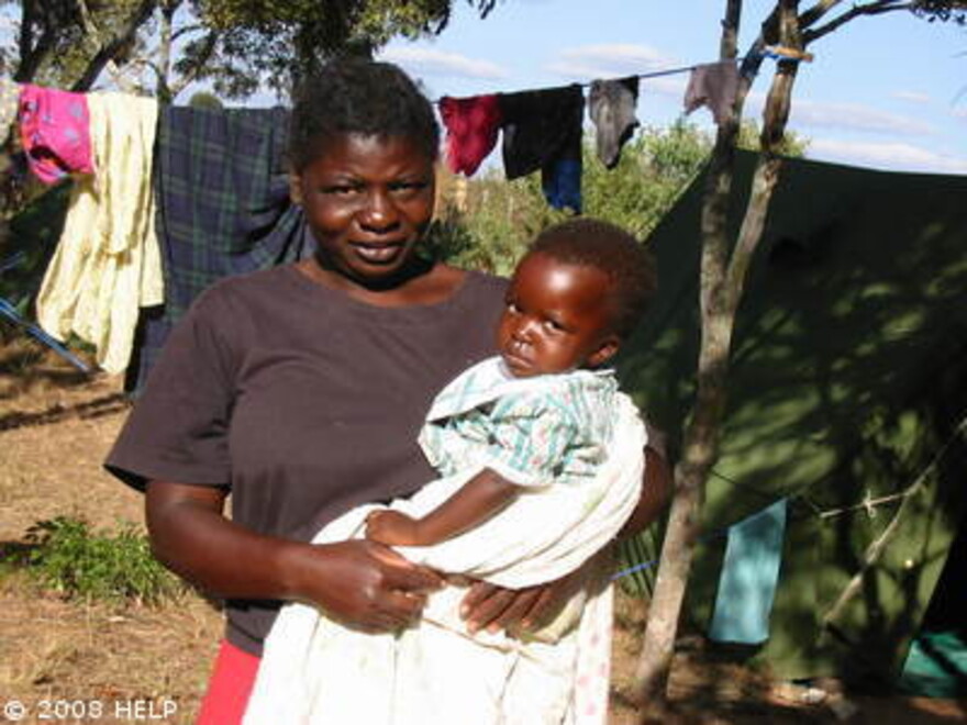 Cholera Simbabwe: Mutter mit ihrem Baby