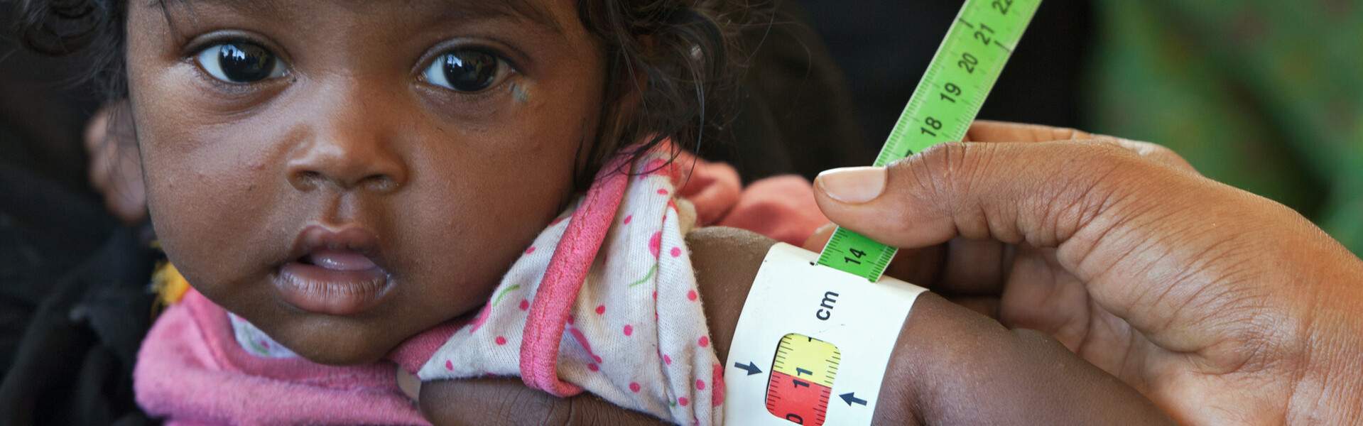Mit dem Hunger-Maßband wird der Ernährungszustand von Kindern gemessen. Das Mädchen auf dem Bild ist an der Grenze zu akuter Mangelernährung