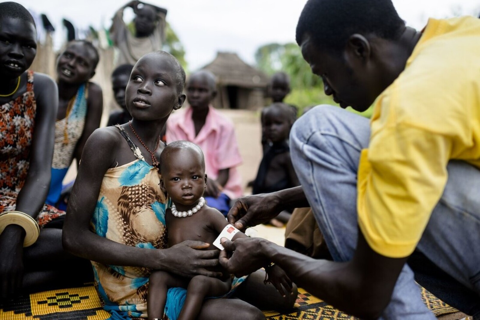 Mithilfe eines Maßbandes wird die Unterernährung bei Kleinkindern festgestellt. Das Kind auf dem Bild ist bereits im kritischen Bereich