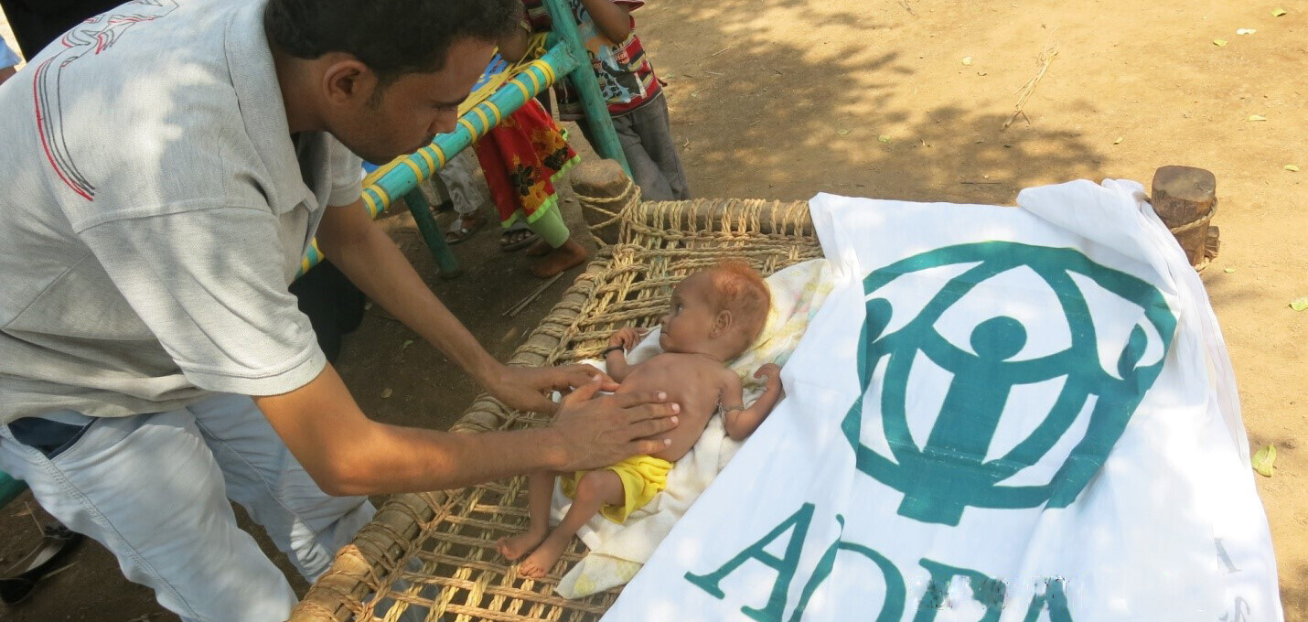 Huda aus dem Jemen wird von Helfern von ADRA behandelt Huda aus dem Jemen wird von Helfern von ADRA behandelt