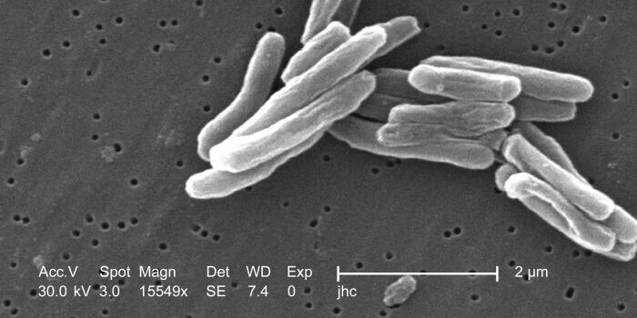 Der Tuberkulose-Erreger Mycobacterium Tuberculosis mikroskopisch vergrößert