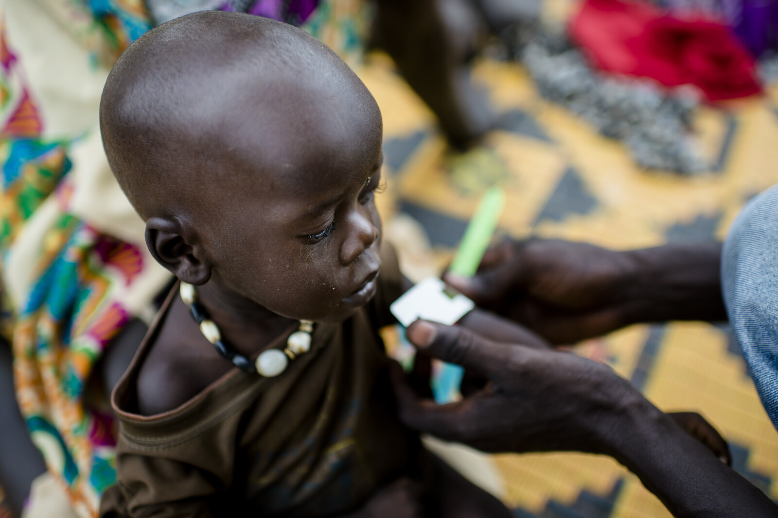 Ein Kind erhält medizinische Hilfe im Südsudan.