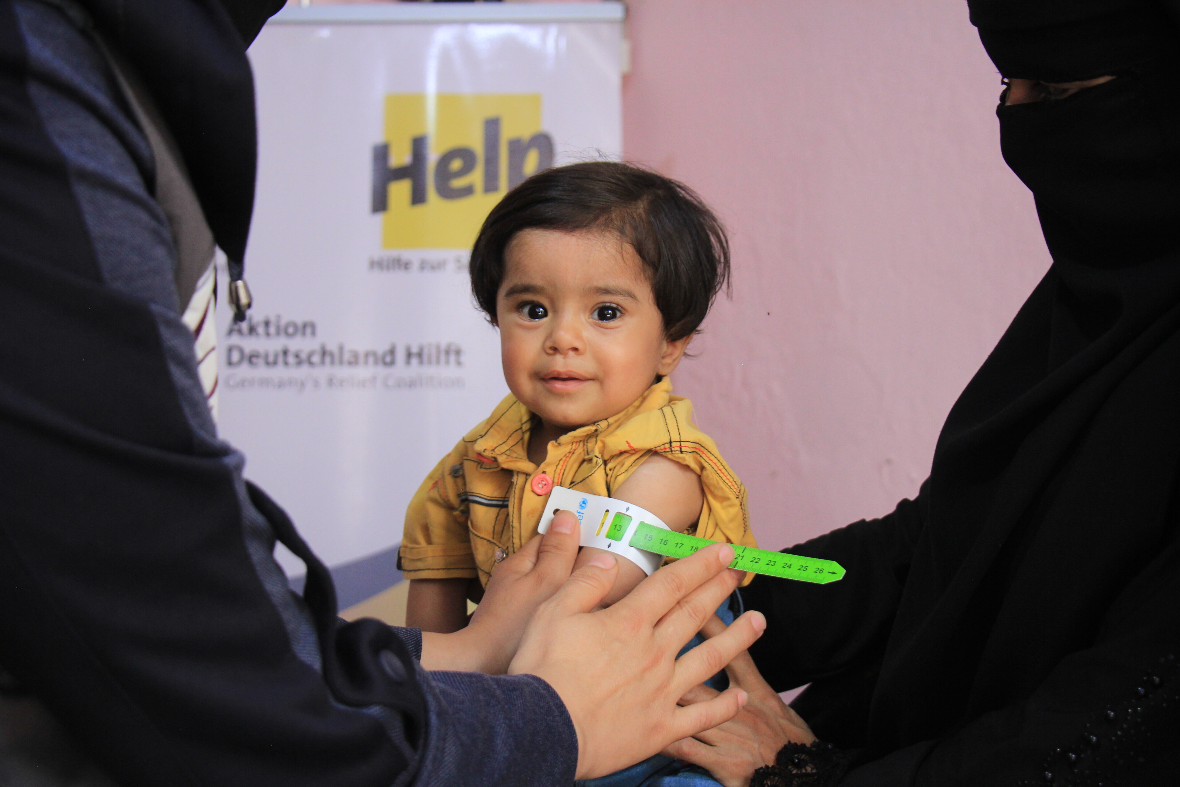 Kind, dessen Oberarm mit einem Hunger-Maßband gemessen wird, in Syrien Kind, dessen Oberarm mit einem Hunger-Maßband gemessen wird, in Syrien