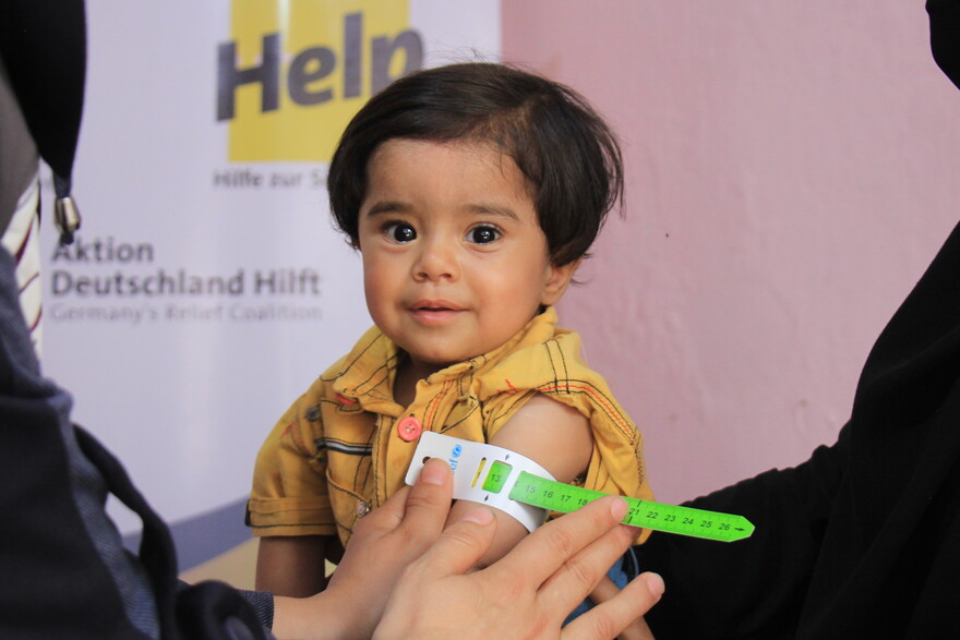Kind, dessen Oberarm mit einem Hunger-Maßband gemessen wird, in Syrien 