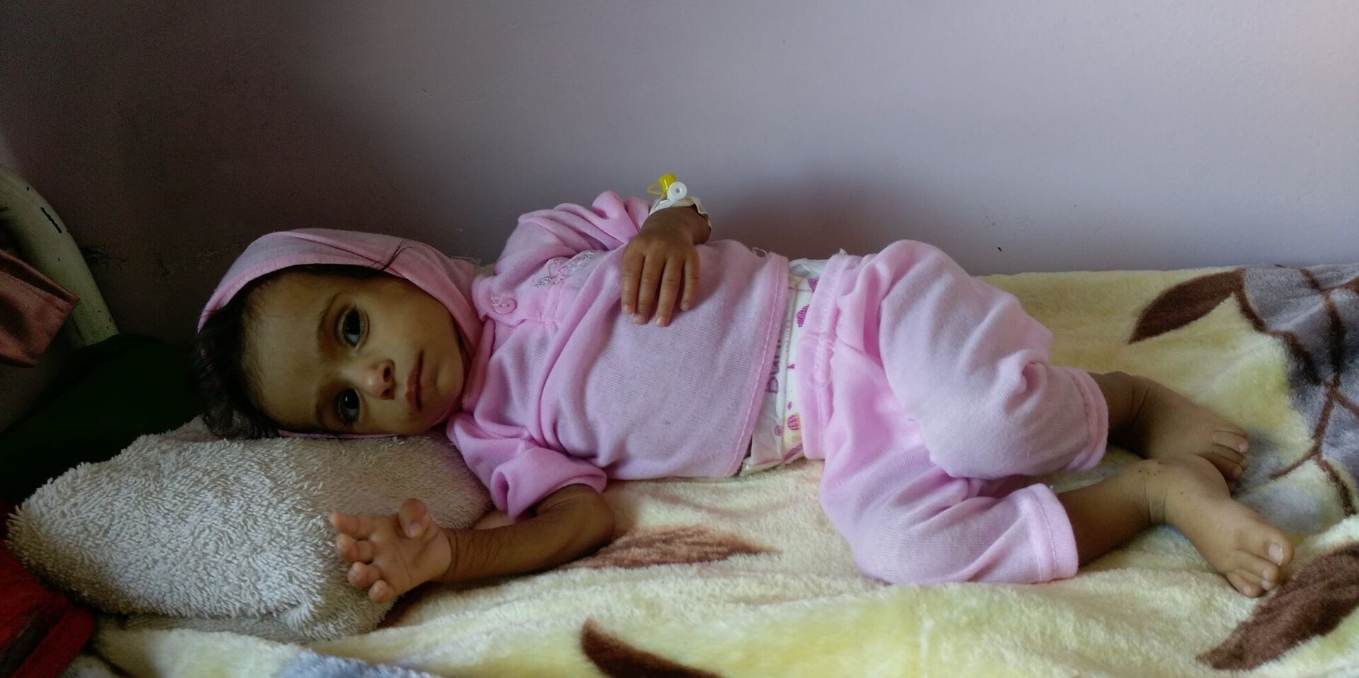 Lebensmittelknappheit im Jemen führt zu starker Unterernährung bei Kleinkindern