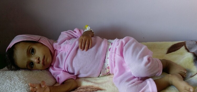 kleines unterernährtes Mädchen liegt auf einer Wolldecke in einem Krankenhaus im Jemen