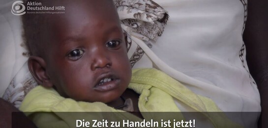 Ein Baby liegt in Bett im Südsudan in Afrika. Es ist betroffen von der Hungerkatastrophe in Afrika.