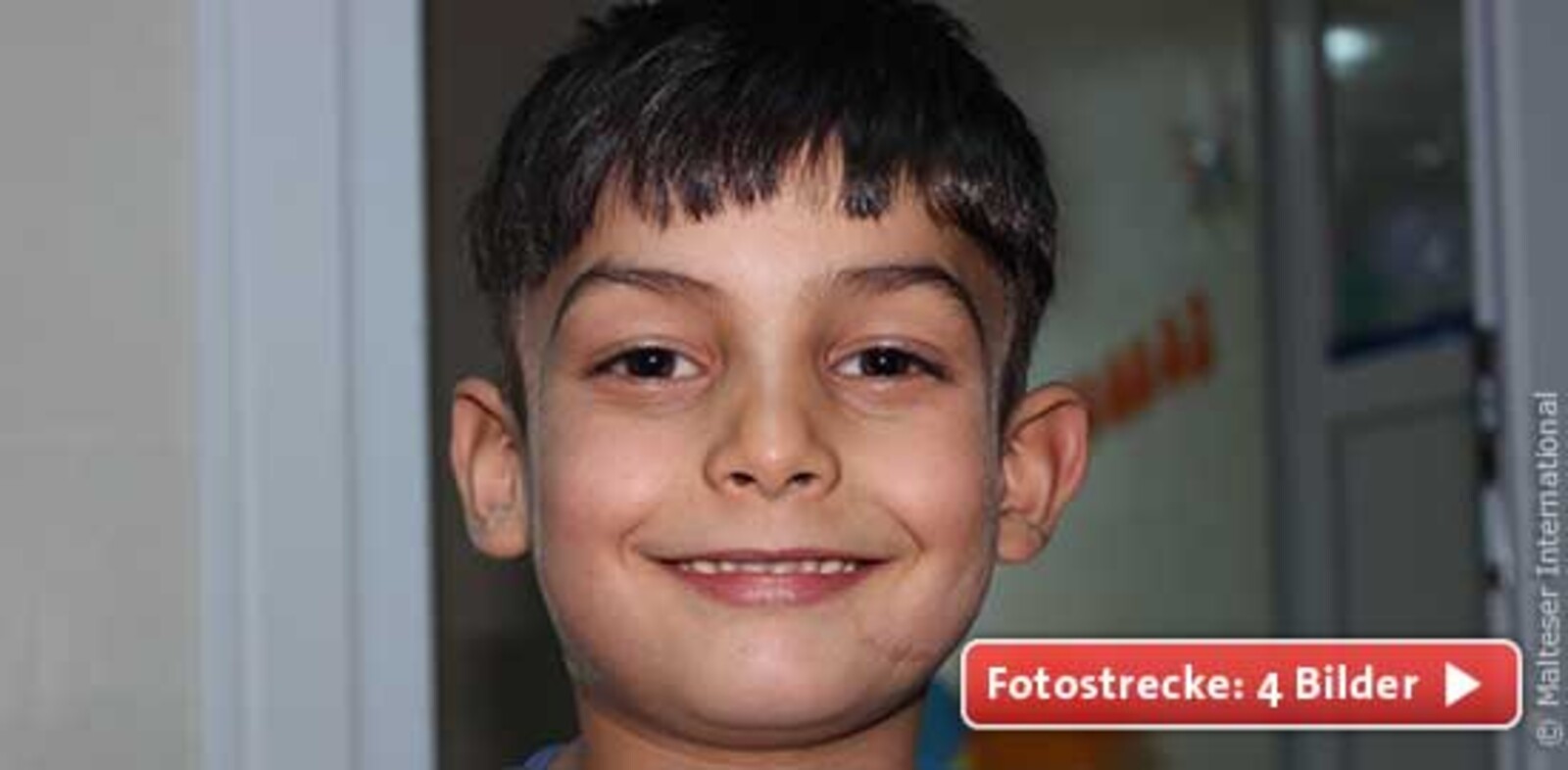 Habib ist gemeinsam mit seiner Mutter aus der syrischen Stadt Aleppo in die Türkei geflüchtet. Durch Granatsplitter einer Bombe wurde sein Bein schwer verletzt. Er musste mehrfach operiert werden