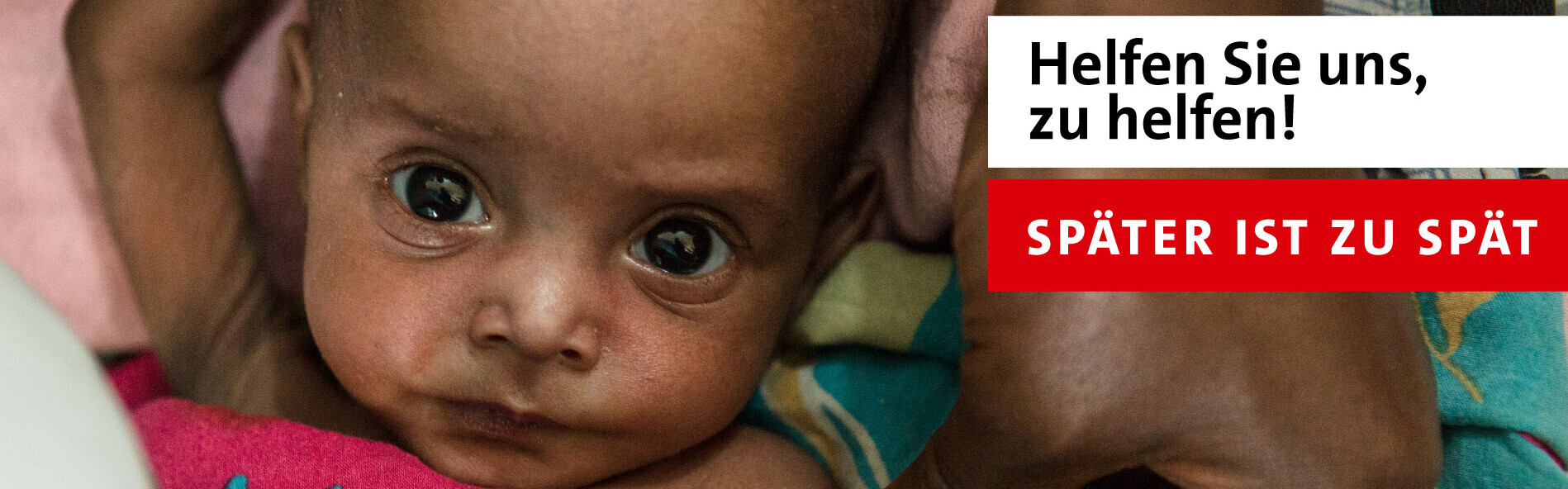 Ein Kind in Somaliland droht zu sterben - wie viele Kinder während der Hungersnot in Afrika