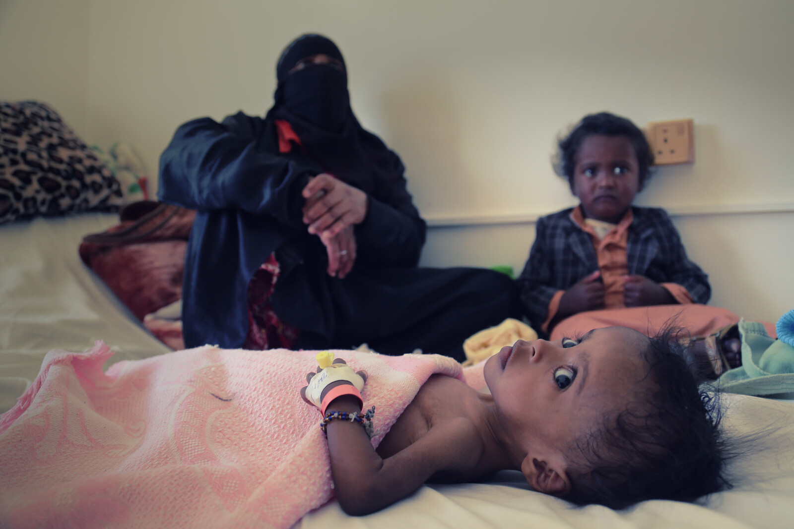 Ein an Cholera erkranktes Kind im Jemen