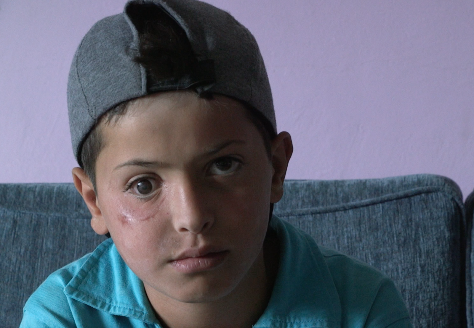 Ayham (13) ist durch einen Anschlag am rechten Auge blind geworden. Mit seinem Vater ist er aus Syrien in den Libanon geflüchtet. Sein Traum: Arzt werden, um Kindern in Syrien später zu helfen. Bildung sieht er als seine Chance. Ayham (13) ist durch einen Anschlag am rechten Auge blind geworden. Mit seinem Vater ist er aus Syrien in den Libanon geflüchtet. Sein Traum: Arzt werden, um Kindern in Syrien später zu helfen. Bildung sieht er als seine Chance.