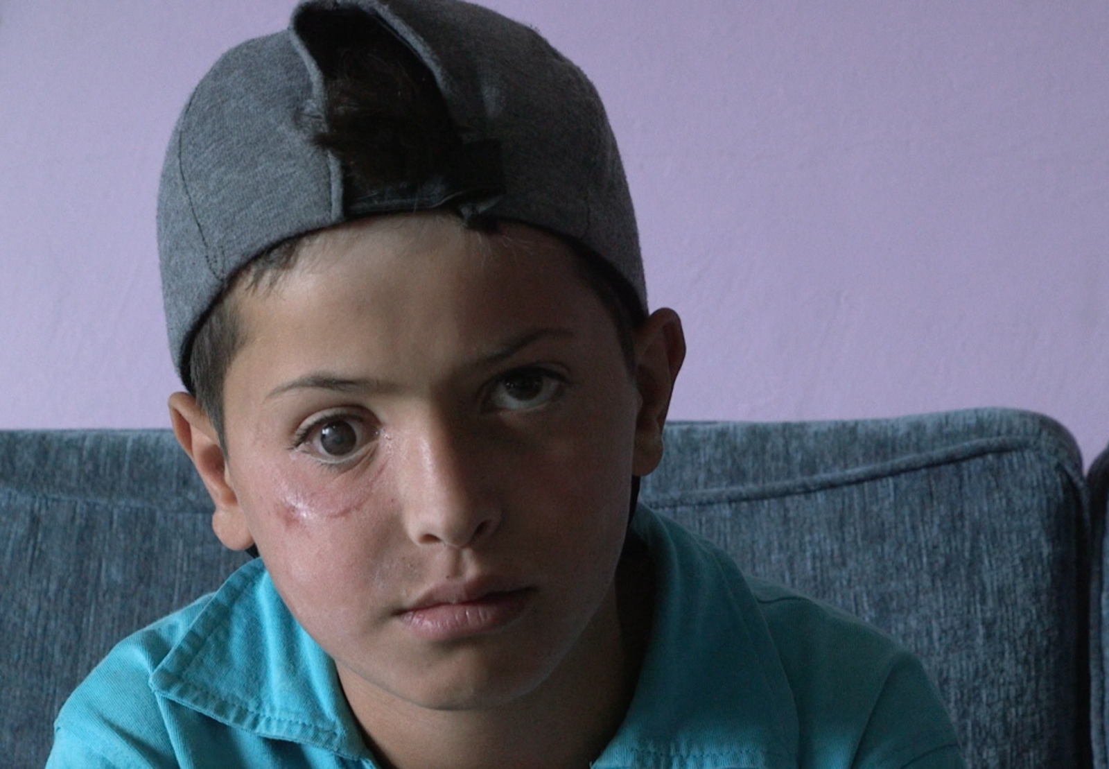 Ayham (13) ist durch einen Anschlag am rechten Auge blind geworden. Mit seinem Vater ist er aus Syrien in den Libanon geflüchtet. Sein Traum: Arzt werden, um Kindern in Syrien später zu helfen. Bildung sieht er als seine Chance.