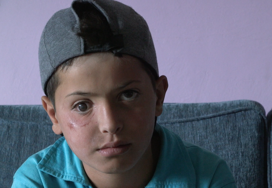Ayham (13) ist durch einen Anschlag am rechten Auge blind geworden. Mit seinem Vater ist er aus Syrien in den Libanon geflüchtet. Sein Traum: Arzt werden, um Kindern in Syrien später zu helfen. Bildung sieht er als seine Chance. Ayham (13) ist durch einen Anschlag am rechten Auge blind geworden. Mit seinem Vater ist er aus Syrien in den Libanon geflüchtet. Sein Traum: Arzt werden, um Kindern in Syrien später zu helfen. Bildung sieht er als seine Chance.