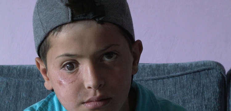 Ayham (13) ist durch einen Anschlag am rechten Auge blind geworden. Mit seinem Vater ist er aus Syrien in den Libanon geflüchtet. Sein Traum: Arzt werden, um Kindern in Syrien später zu helfen. Bildung sieht er als seine Chance.