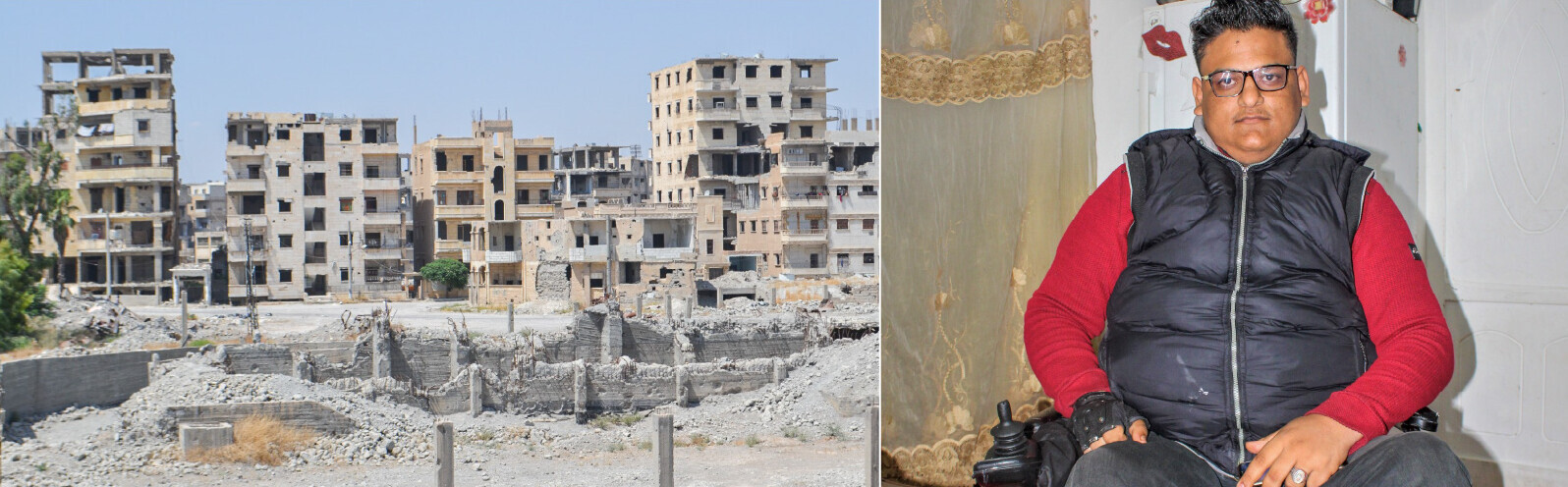 Osamas Wirbelsäule wurde bei einem Bombenangriff in Syrien verletzt – nun sitzt er im Rollstuhl