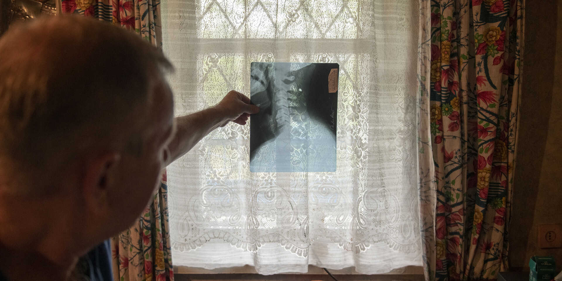 Ein Mann betrachtet ein Röntgenbild von seinem Hals