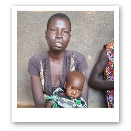 Flüchtlinge Achol und ihr Sohn Muluk leiden Hunger im Südsudan Flüchtlinge Achol und ihr Sohn Muluk leiden Hunger im Südsudan