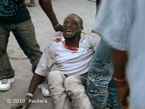 Erdbeben Haiti. Verletzter Mann